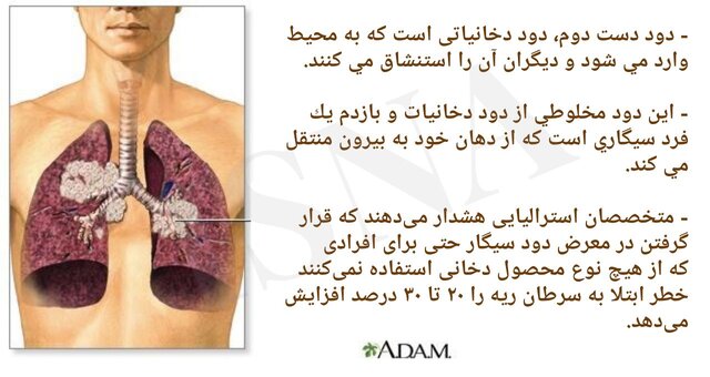 ژِستی که به قیمت جان تمام میشود 6 ژِستی که به قیمت جان تمام میشود