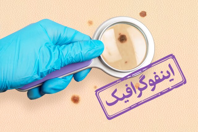 اینفوگرافیک/ غربالگری سرطانهای شایع در کشور 1 d8a7db8cd986d981d988daafd8b1d8a7d981db8cdaa9 d8bad8b1d8a8d8a7d984daafd8b1db8c d8b3d8b1d8b7d8a7d986d987d8a7db8c d8b4d8a7db8cd8b9 6924a11c818c6