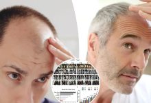 d988db8cd8afdb8cd988 d985d8add982d982d8a7d986 daa9d8b4d981 daa9d8b1d8afd986d8afd89b d8b1d8a7d987db8c d8acd8afdb8cd8af d8a8d8b1d8a7db8c 692454d0e8da3