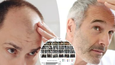 d988db8cd8afdb8cd988 d985d8add982d982d8a7d986 daa9d8b4d981 daa9d8b1d8afd986d8afd89b d8b1d8a7d987db8c d8acd8afdb8cd8af d8a8d8b1d8a7db8c 692454d0e8da3