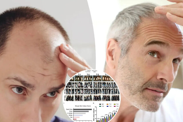 ویدیو/ محققان کشف کردند؛ راهی جدید برای توقف ریزش مو