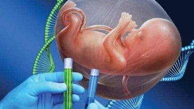 d8acd984d988daafdb8cd8b1db8c d8a7d8b2 d986d8a7d8aad988d8a7d986db8c d8b0d987d986db8c d988 d986d8a7d8b4d986d988d8a7db8cdb8c d8a8d8a7 69459fd2f1a43